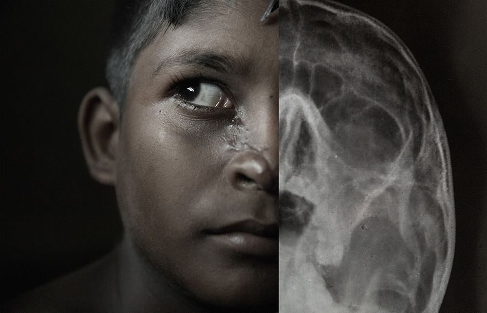 Destruction Of Coastal West Bengal Due To Fequent Cyclones Caused By Global Warming