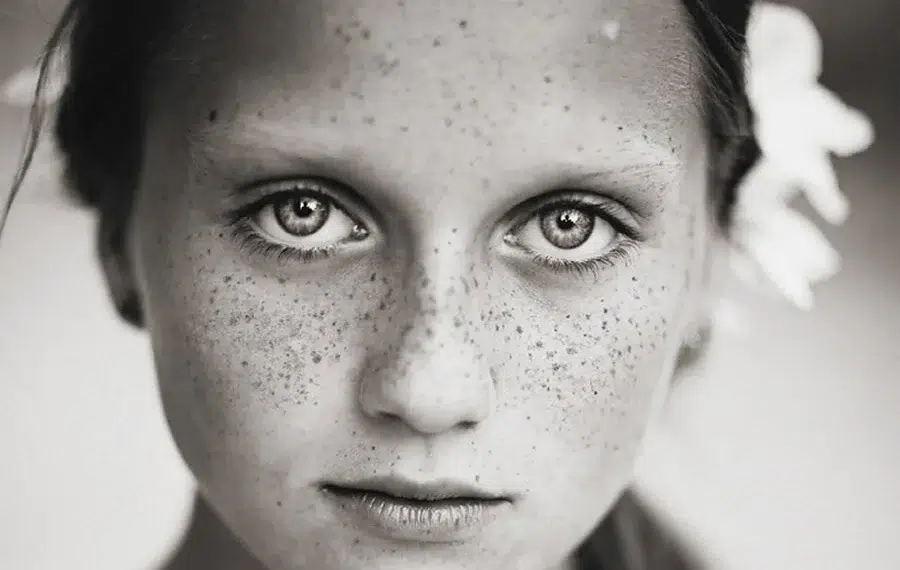 Close-up black and white portrait of a freckled girl with intense eyes