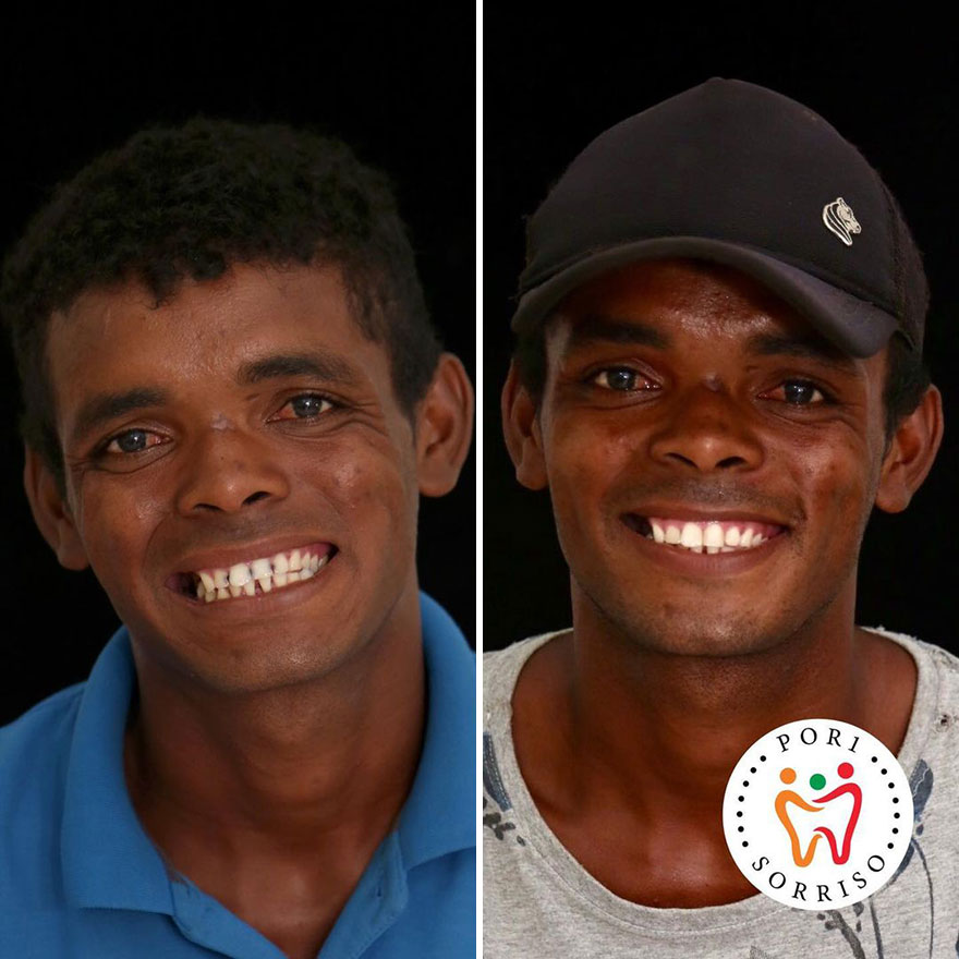 Brazilian Dentist Felipe Rossi Treat The Teeth Of Poor People