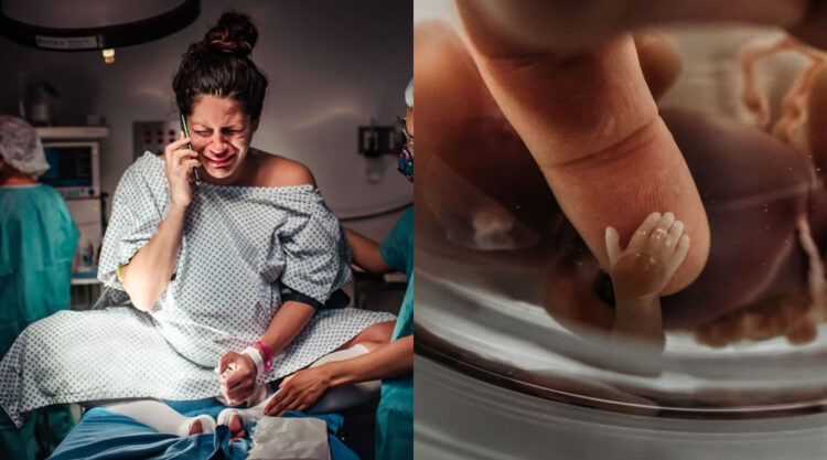 Mind-Blowing Winning Photos Of 2022 Birth Photography Image Competition
