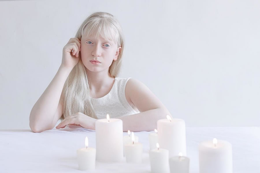 Photographer Yulia Taits Captured The Beauty Of Albino People