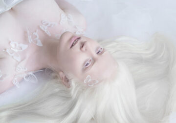 Photographer Yulia Taits Captured The Beauty Of Albino People