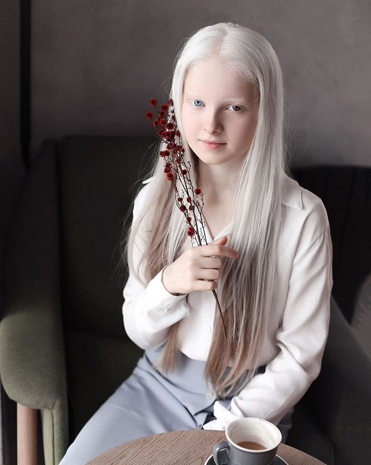 Beautiful Girl With Albinism And Heterochromia