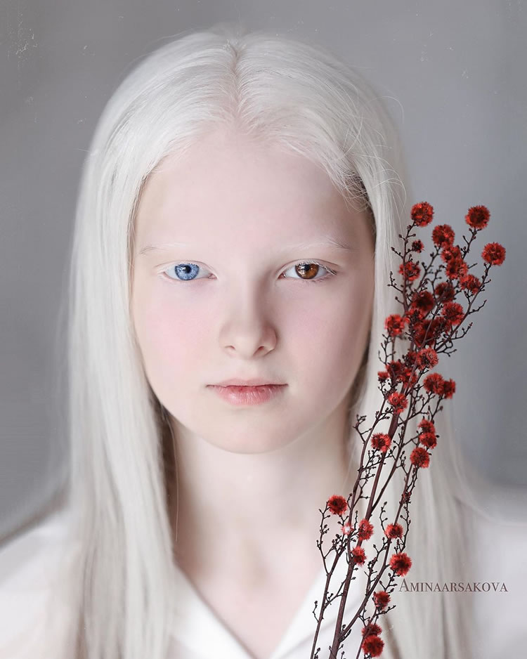 Photographer Captured The Ethereal Portraits Of Beautiful Girl With Albinism And Heterochromia 