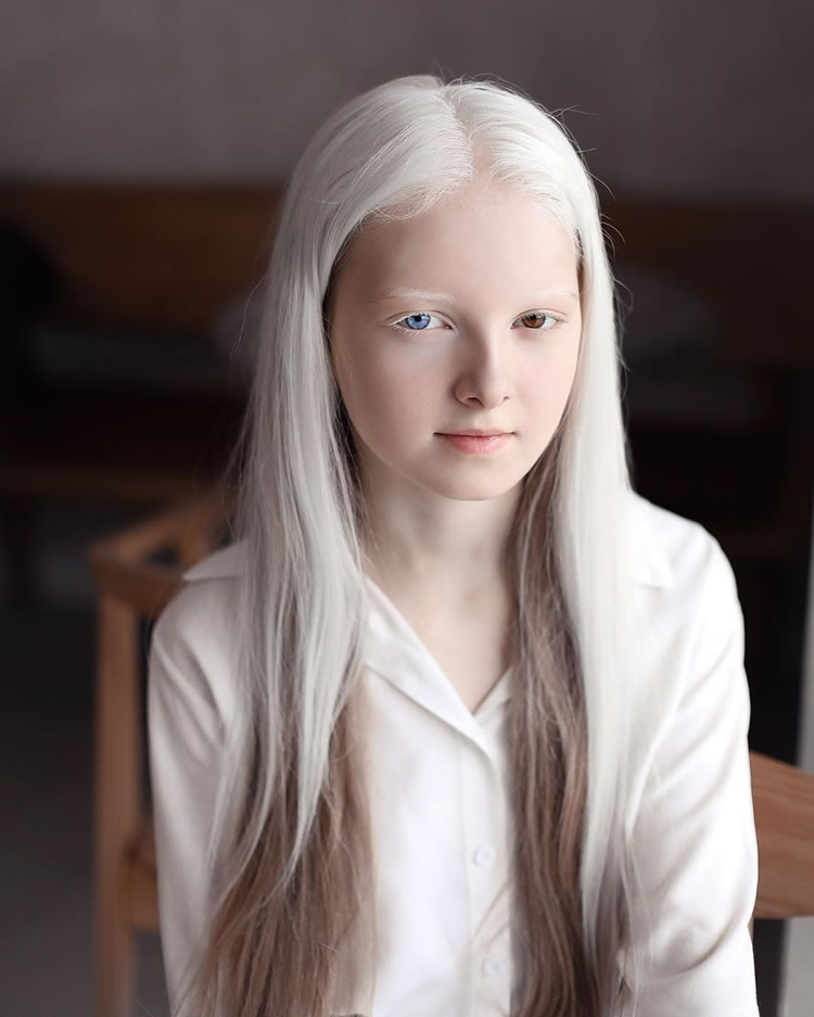 Beautiful Albino People