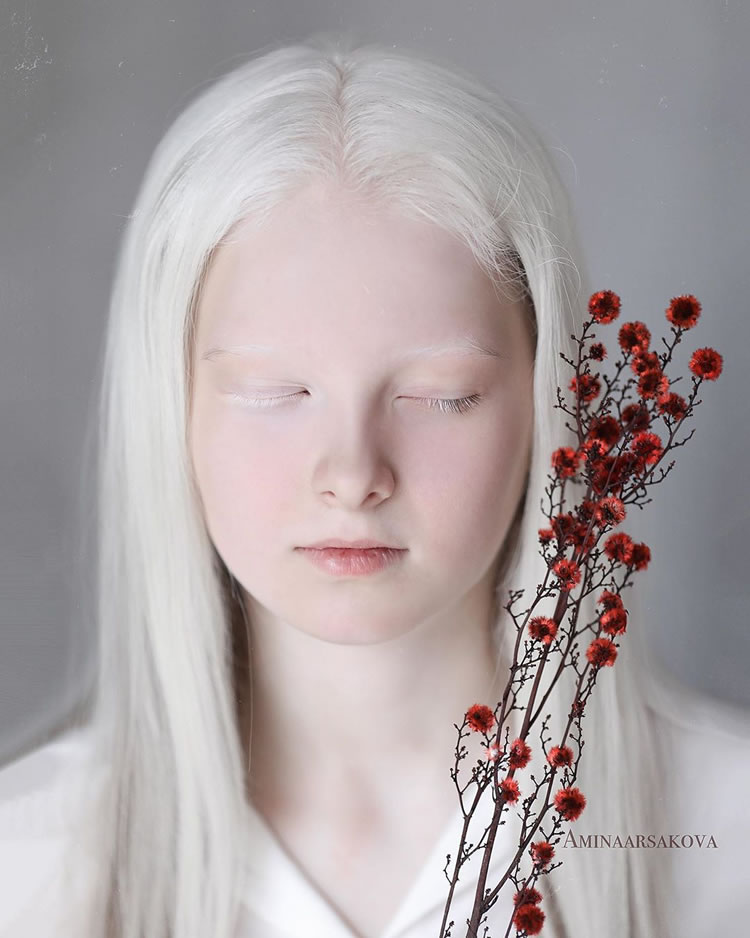 Photographer Captured The Ethereal Portraits Of Beautiful Girl With Albinism And Heterochromia 