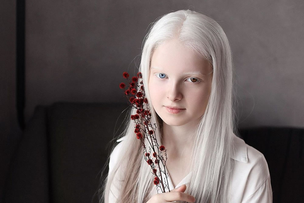 beautiful albino people