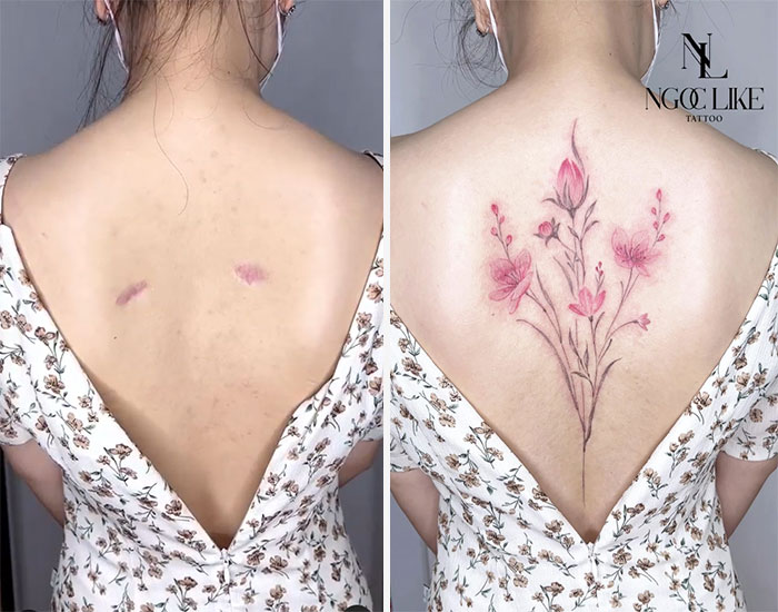 Scars Cover Up Tattoos By Tran Thi Bich Ngoc