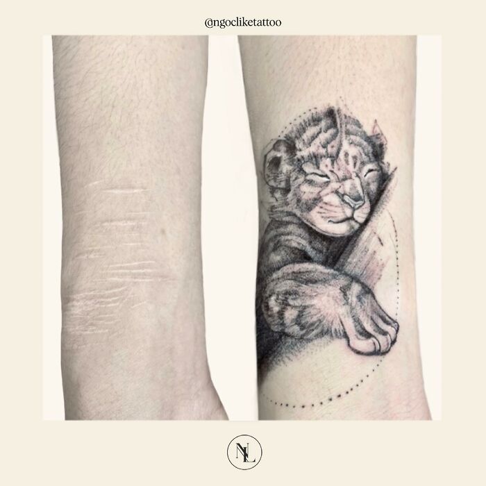 Scars Cover Up Tattoos By Tran Thi Bich Ngoc