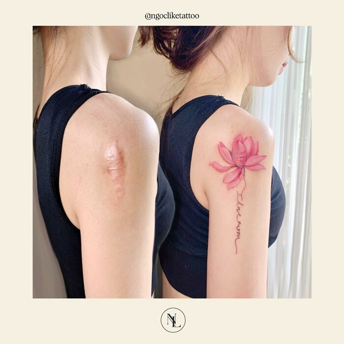 Scars Cover Up Tattoos By Tran Thi Bich Ngoc