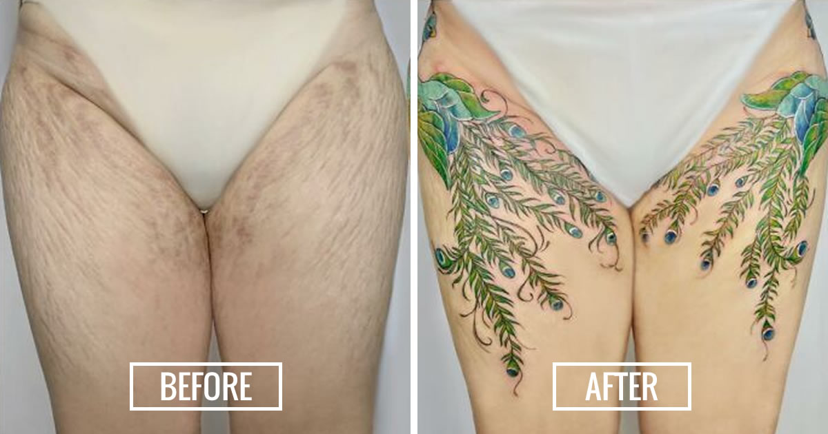 Tattooing scars and stretchmarks - Timeless Tattoo 2023
