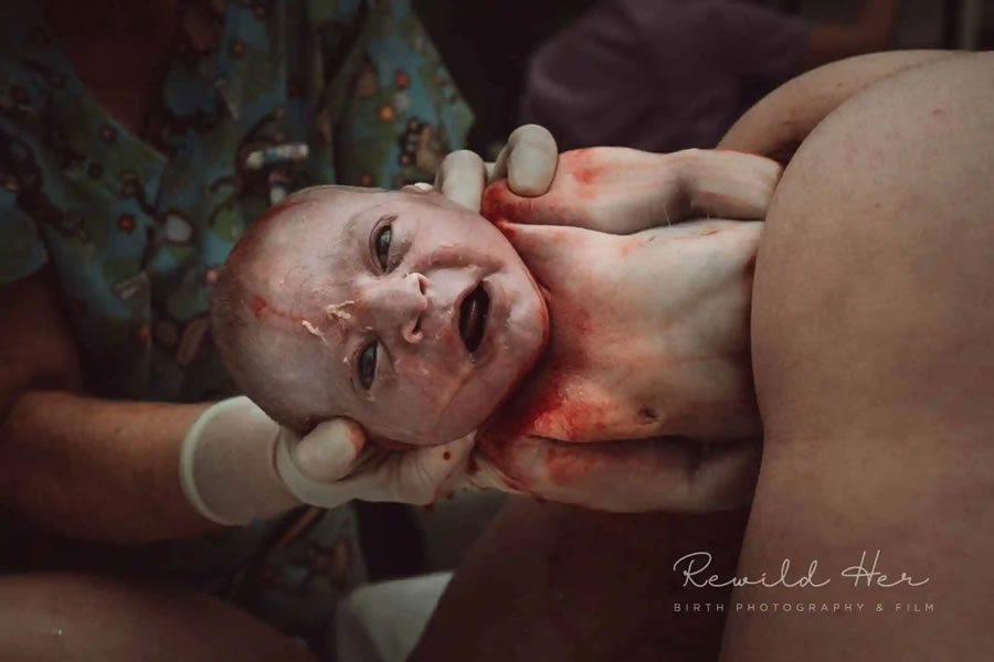 Birth Photography Image Competition Winnners
