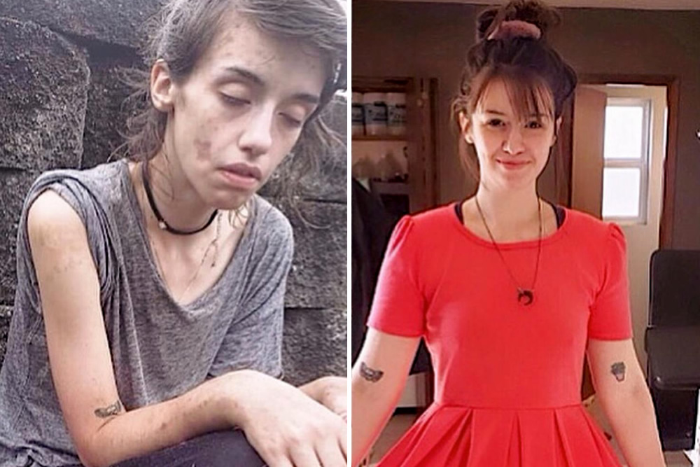 Before and After Photos