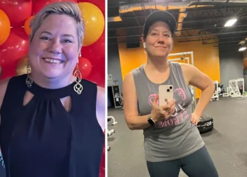 A woman's before and after weight loss transformation photos