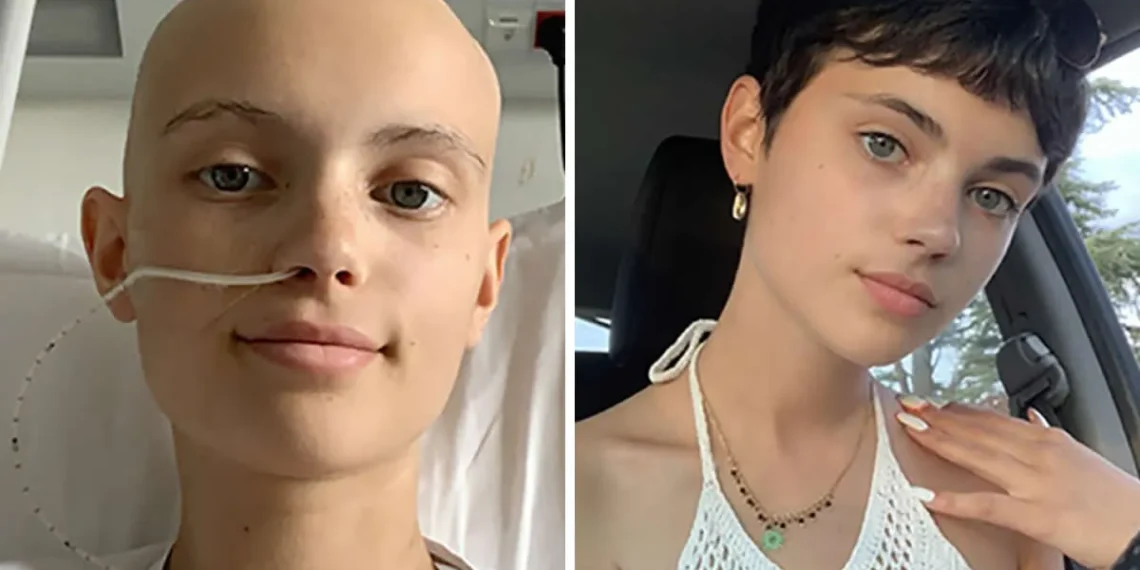 30 Emotional Stories That Will Warm Your Heart and Bring Tears of Joy 31 Young woman before and after cancer recovery, heart-touching photography
