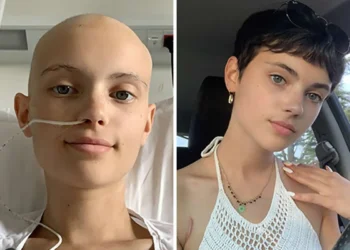 Young woman before and after cancer recovery, heart-touching photography