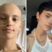 Young woman before and after cancer recovery, heart-touching photography