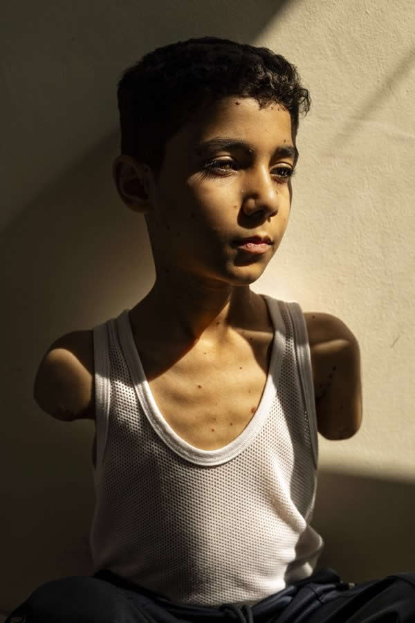 Powerful Photo of Injured Palestinian Boy Wins 2025 World Press Photo of the Year