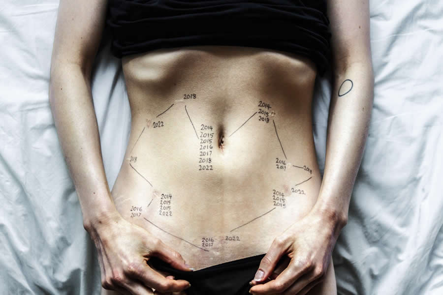 Powerful Photos from the Wellcome Photography Prize 2025