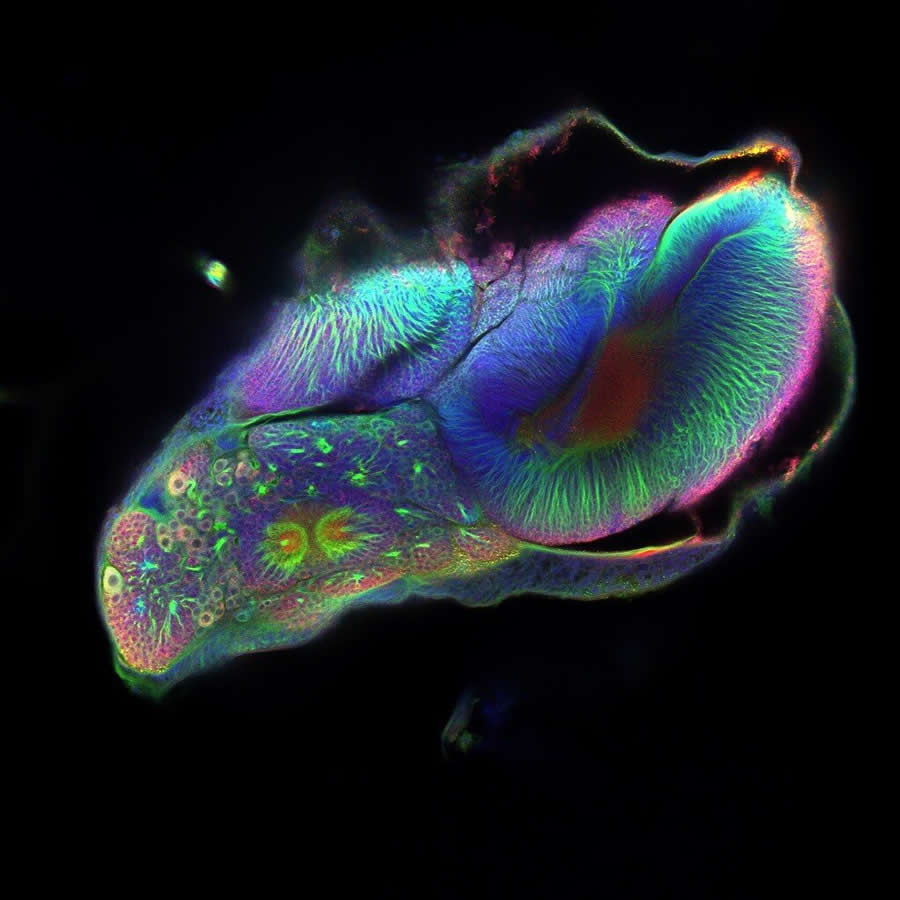 Powerful Photos from the Wellcome Photography Prize 2025