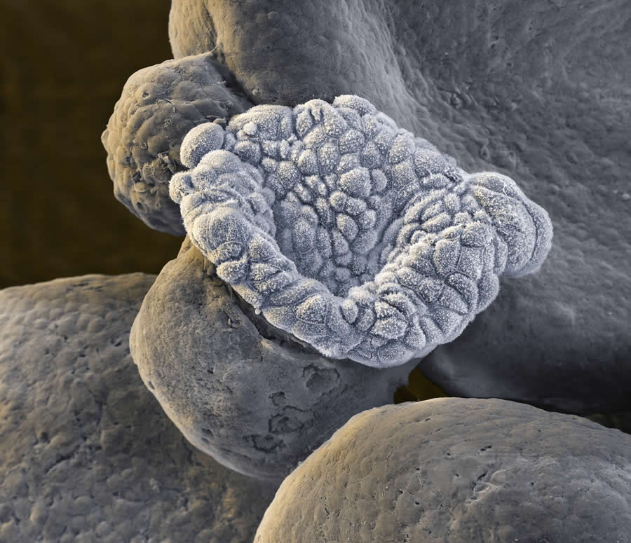 Powerful Photos from the Wellcome Photography Prize 2025