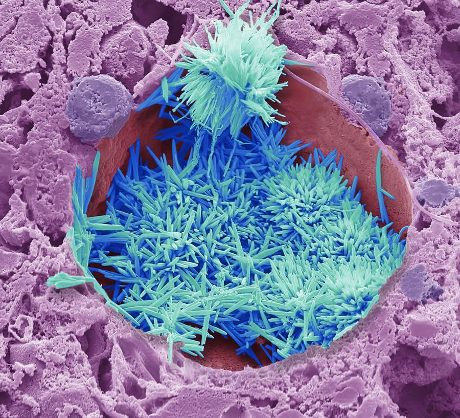 Powerful Photos from the Wellcome Photography Prize 2025