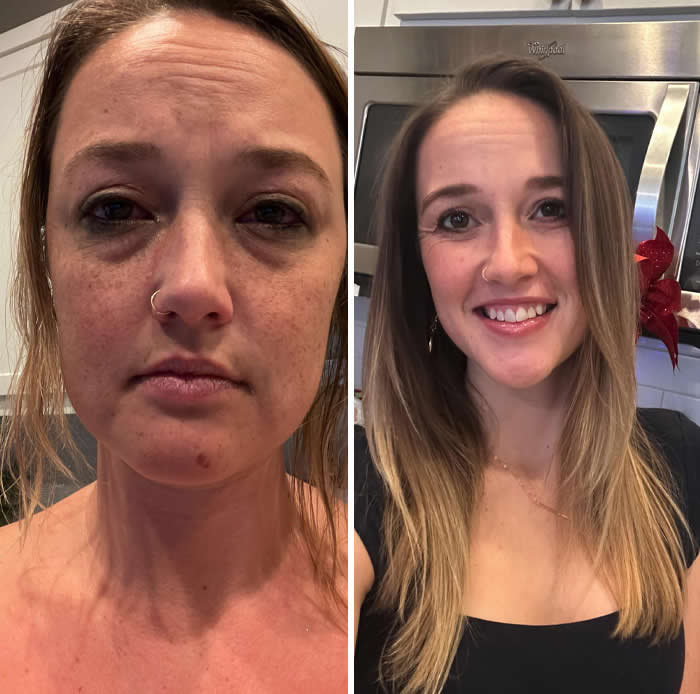 Inspiring Before-and-After Stories