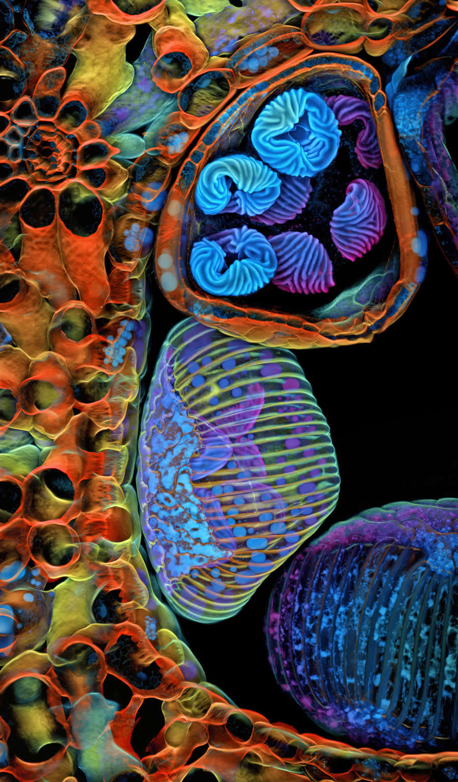 Spores of a small tropical fern by Dr. Igor Robert Siwanowicz - 2025 Nikon Small World Photomicrography Competition Winners