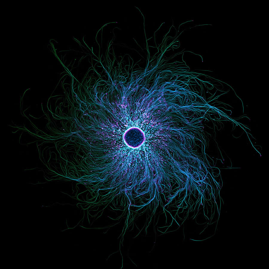 iPSC-derived sensory neurons labelled to show tubulin and actin by Stella Whittaker - 2025 Nikon Small World Photomicrography Competition Winners