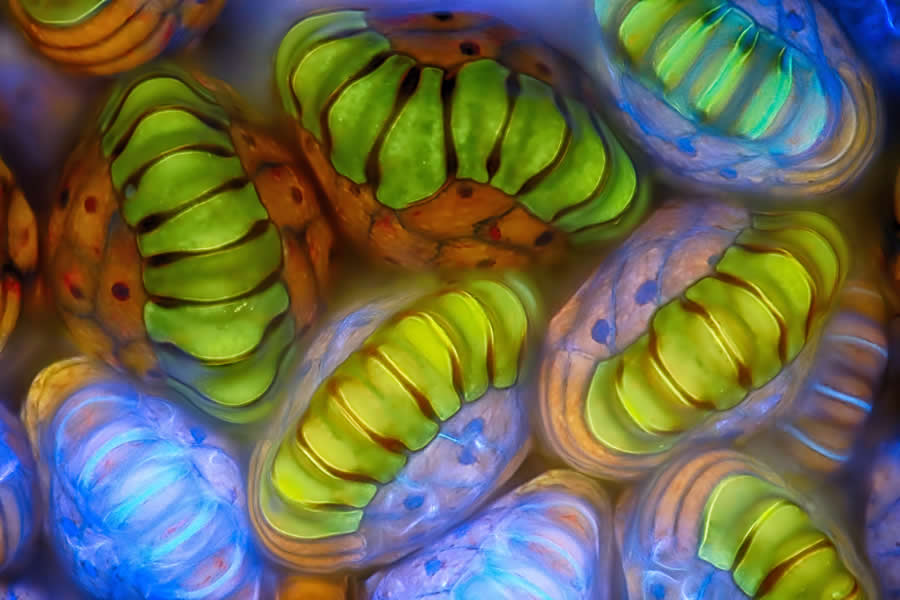 Spore sacs of a fern by Rogelio Moreno - 2025 Nikon Small World Photomicrography Competition Winners