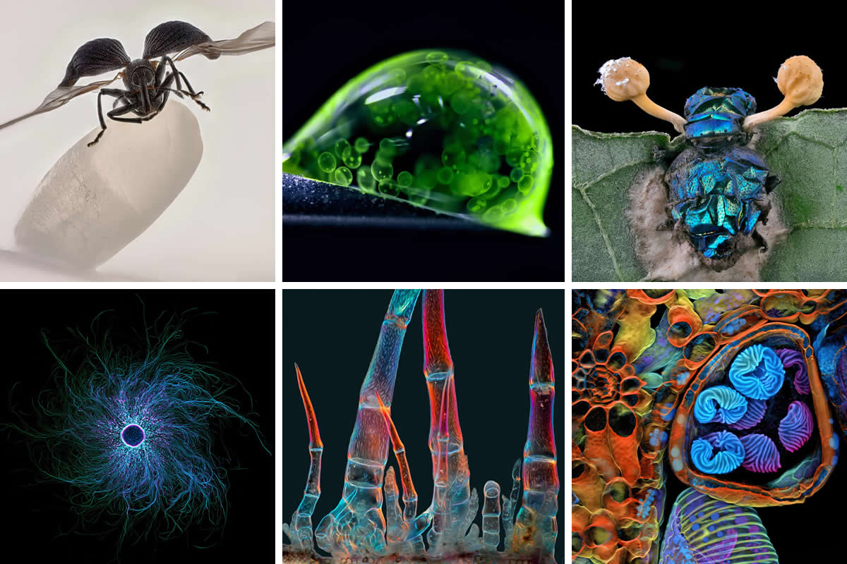 2025 Nikon Small World Photomicrography Competition Winners