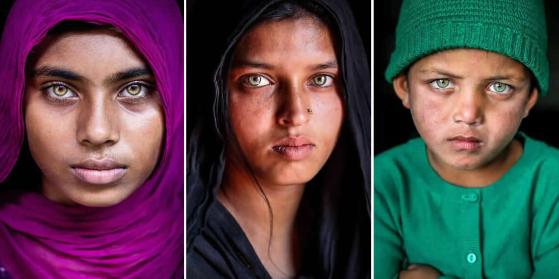 Mou Aysha: Capturing Rare Light-Eyed Beauty in Bangladesh