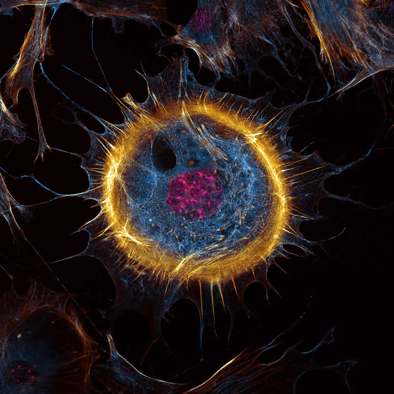 "Mouse embryonic fibroblast" by Joe McKellar, France - Award-Winning Microscope Photos of 2026