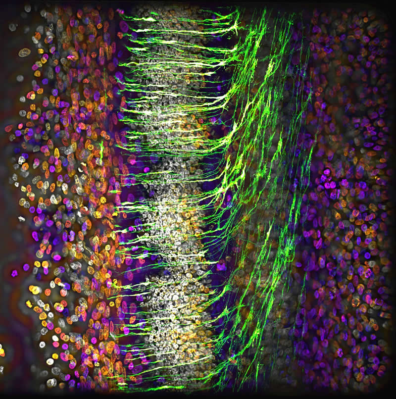"Commissural axons navigating across the midline of a developing central nervous system in a chick embryo" by Alexandre Dumoulin, Switzerland - Award-Winning Microscope Photos of 2026
