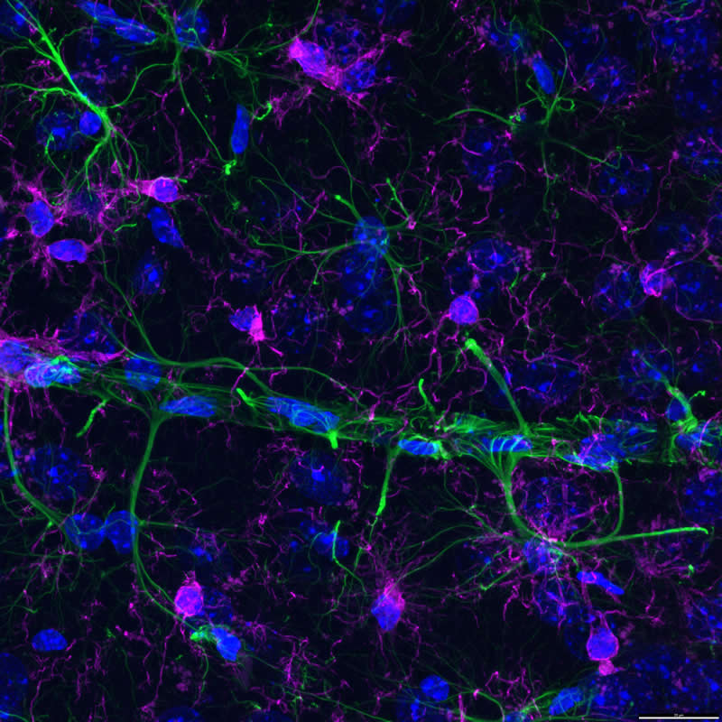 "Fluorescent immunostained brain tissue from an Alzheimer&rsquo;s disease mouse model" by Bettina R&aacute;k&oacute;czi, Hungary - Award-Winning Microscope Photos of 2026