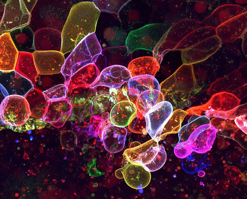 "Dying superficial epithelial cells during osmotic stress" by Yue Rong Tan, Taiwan - Award-Winning Microscope Photos of 2026