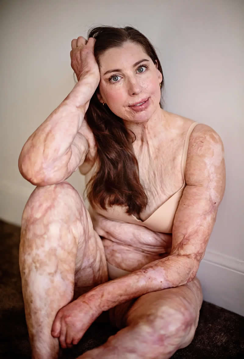 The Outside of the Inside by MarMartina Holmberg, Sweden - AAP Magazine 2026 Portrait Awards Winners