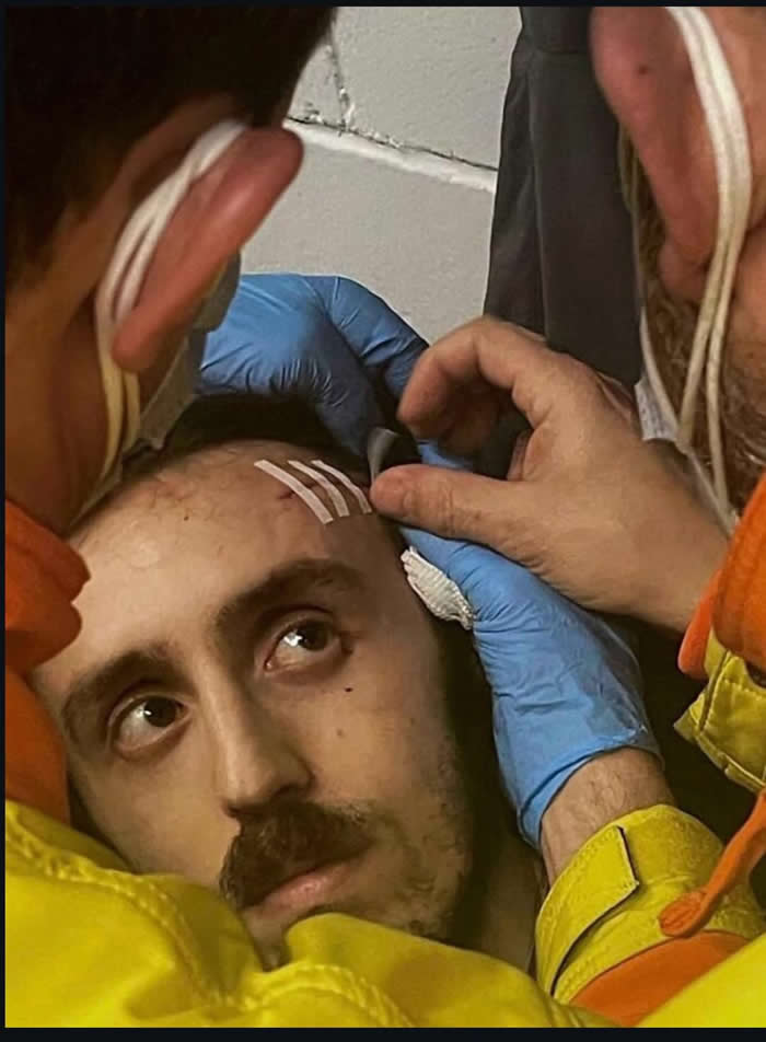 His face is from 1600s paintings - Photos looks like Paintings