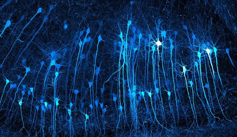 42 Award-Winning Photos From Nikon Small World Photomicrography Competition Reveal a Hidden Universe 47 3rd Place: Neurons in an expanded mouse brain by Kaelin Wulf & Rachel Flannery - Nikon Small World Photomicrography Competition Winners