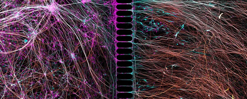 42 Award-Winning Photos From Nikon Small World Photomicrography Competition Reveal a Hidden Universe 51 7th Place: Human neurons reprogrammed from skin cells growing in a microfluidic chamber by Dr. Bruno Cisterna & Dr. Eric Vitriol - Nikon Small World Photomicrography Competition Winners