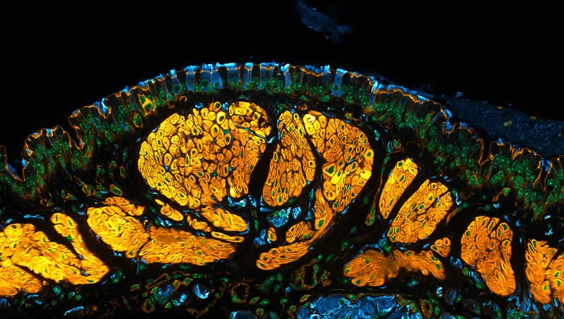 42 Award-Winning Photos From Nikon Small World Photomicrography Competition Reveal a Hidden Universe 59 15th Place: Mouse trachea showing tiny hair-like cells that move mucus and nearby nerves (blue) associated with the muscles (yellow) by Dr. Julien Resseguier - Nikon Small World Photomicrography Competition Winners