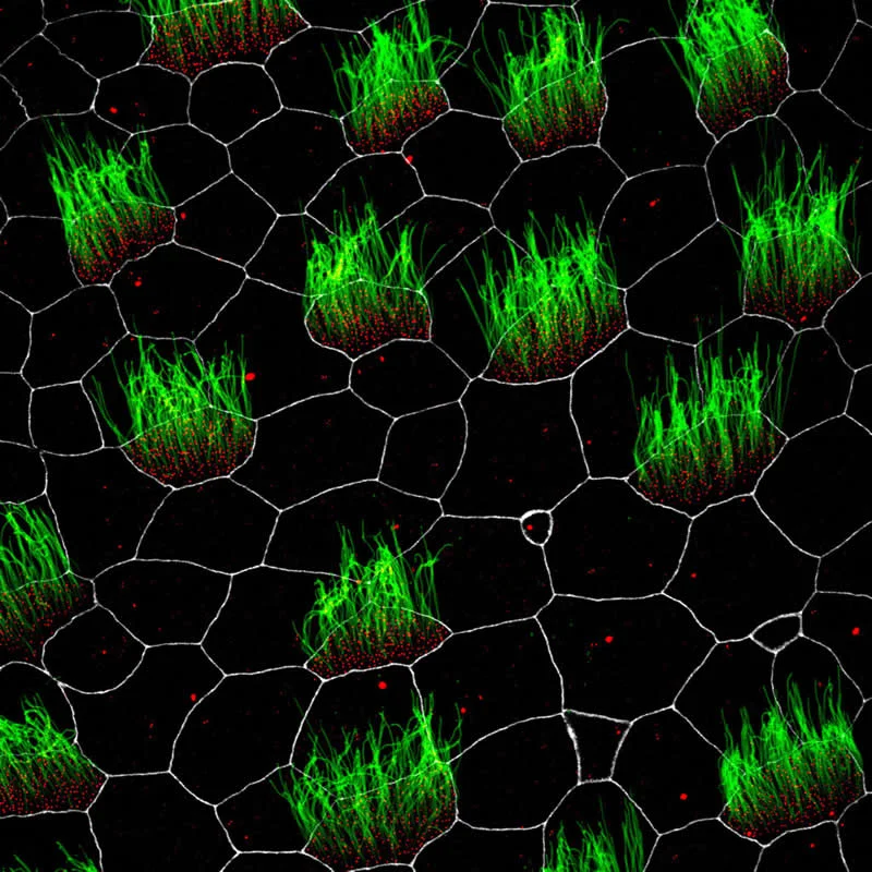 42 Award-Winning Photos From Nikon Small World Photomicrography Competition Reveal a Hidden Universe 60 16th Place: Embryonic Xenopus skin cells, showing cilia (green), centrioles (red), and cell membranes (white) by Pierre Nouaux & Laurent Kodjabachian, Camille Boutin - Nikon Small World Photomicrography Competition Winners