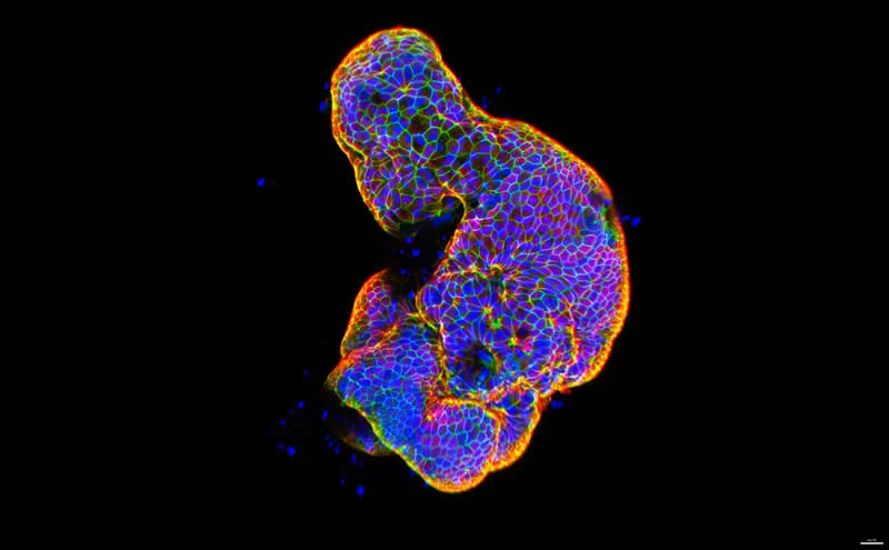 42 Award-Winning Photos From Nikon Small World Photomicrography Competition Reveal a Hidden Universe 61 17th Place: Lab-grown human intestinal tissue showing glowing, brick-like epithelial cell connections that form the intestine's protective barrier by Dr. Gauri Kulkarni - Nikon Small World Photomicrography Competition Winners