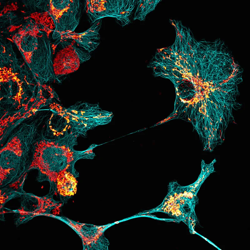 42 Award-Winning Photos From Nikon Small World Photomicrography Competition Reveal a Hidden Universe 67 African green monkey kidney cells (COS-7) displaying the microtubule network (cyan) and mitochondria (red and yellow) by Walid Idi - Nikon Small World Photomicrography Competition Winners
