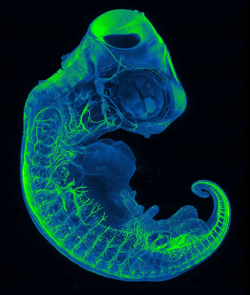 42 Award-Winning Photos From Nikon Small World Photomicrography Competition Reveal a Hidden Universe 70 Neurons of red-eared slider (Trachemys scripta) embryo by Amartya Tashi Mitra, Paul Maier, Aria Huang, Nathaniel Sweet, Anthony Wokasch - Nikon Small World Photomicrography Competition Winners