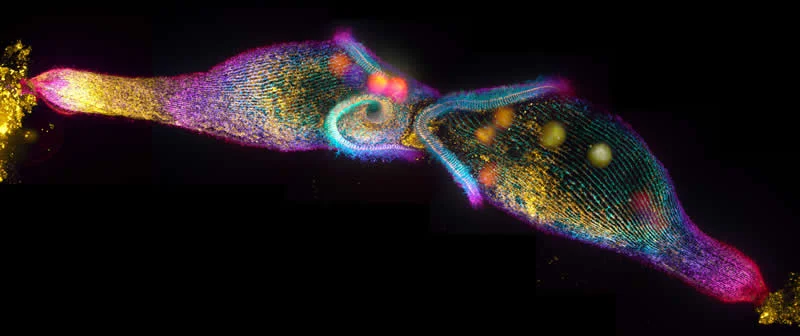 42 Award-Winning Photos From Nikon Small World Photomicrography Competition Reveal a Hidden Universe 73 A pair of elongated Stentor coeruleus cells during mating. The cells are fused at anterior edge of their mouth to allow for the transfer of DNA. by Dr. Mark Slabodnick - Nikon Small World Photomicrography Competition Winners