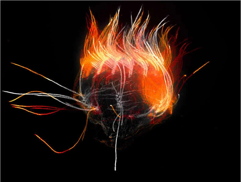 42 Award-Winning Photos From Nikon Small World Photomicrography Competition Reveal a Hidden Universe 74 Cytoskeleton stain of the “jumping” ciliate Halteria grandinella, a common pondwater protist by Rocky An, Dr. Manu Prakash - Nikon Small World Photomicrography Competition Winners