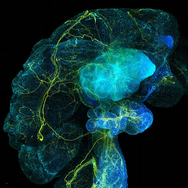 42 Award-Winning Photos From Nikon Small World Photomicrography Competition Reveal a Hidden Universe 75 Nerves and vasculature connecting the ovary, fallopian tubes, and uterus in a mouse (Mus musculus) by Claire J Ang - Nikon Small World Photomicrography Competition Winners