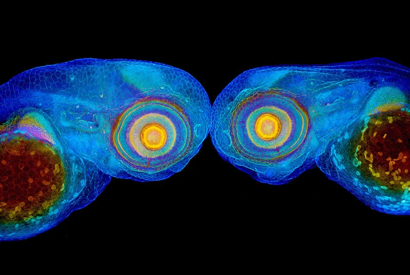 42 Award-Winning Photos From Nikon Small World Photomicrography Competition Reveal a Hidden Universe 77 Paired zebrafish embryos by Dr. Dylan T. Burnette & Dr. James Hayes - Nikon Small World Photomicrography Competition Winners
