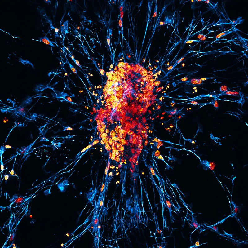 42 Award-Winning Photos From Nikon Small World Photomicrography Competition Reveal a Hidden Universe 79 Human neurons (differentiated from induced pluripotent stem cells) by Faith Fernandes, Dr. James Glover - Nikon Small World Photomicrography Competition Winners